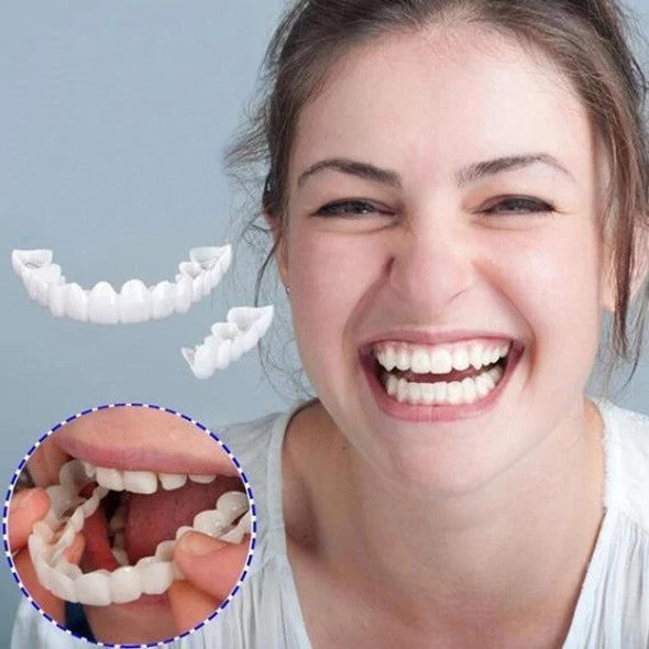 Annie’s Fashion Instant Smile Veneers – Upper & Lower Clip-On Dental Veneer Set