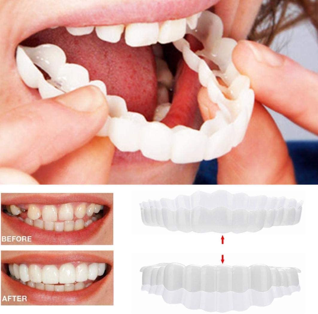 Annie’s Fashion Instant Smile Veneers – Upper & Lower Clip-On Dental Veneer Set