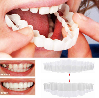 Annie’s Fashion Instant Smile Veneers – Upper & Lower Clip-On Dental Veneer Set