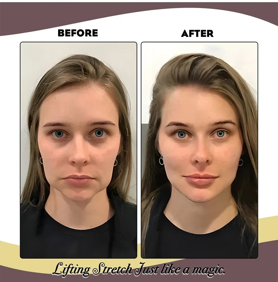 Face Lifting Band | Invisible Elastic Support Band