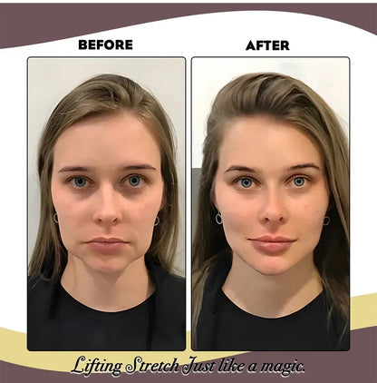 Face Lifting Band | Invisible Elastic Support Band