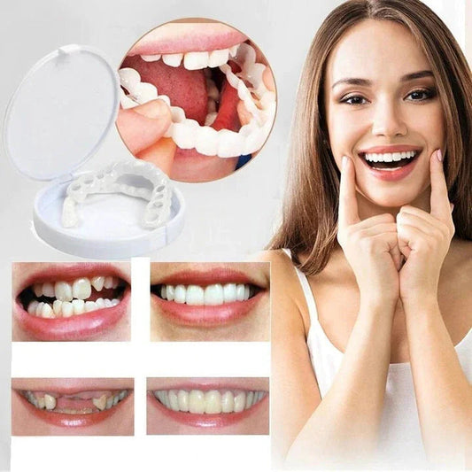 Annies-fashion – Snap-On Veneers Set for Upper & Lower Teeth with Custom Fit | Removable Solution for a Natural-Looking Smile