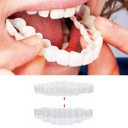 Annie’s Fashion Instant Smile Veneers – Upper & Lower Clip-On Dental Veneer Set