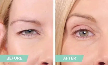 Annie’s Fashion New Glue-Free Ultra Natural Invisible Double Eyelid Sticker