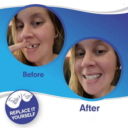 Clip On Teeth Veneer Set for Upper and Lower Coverage
