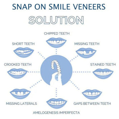Clip On Teeth Veneer Set for Upper and Lower Coverage