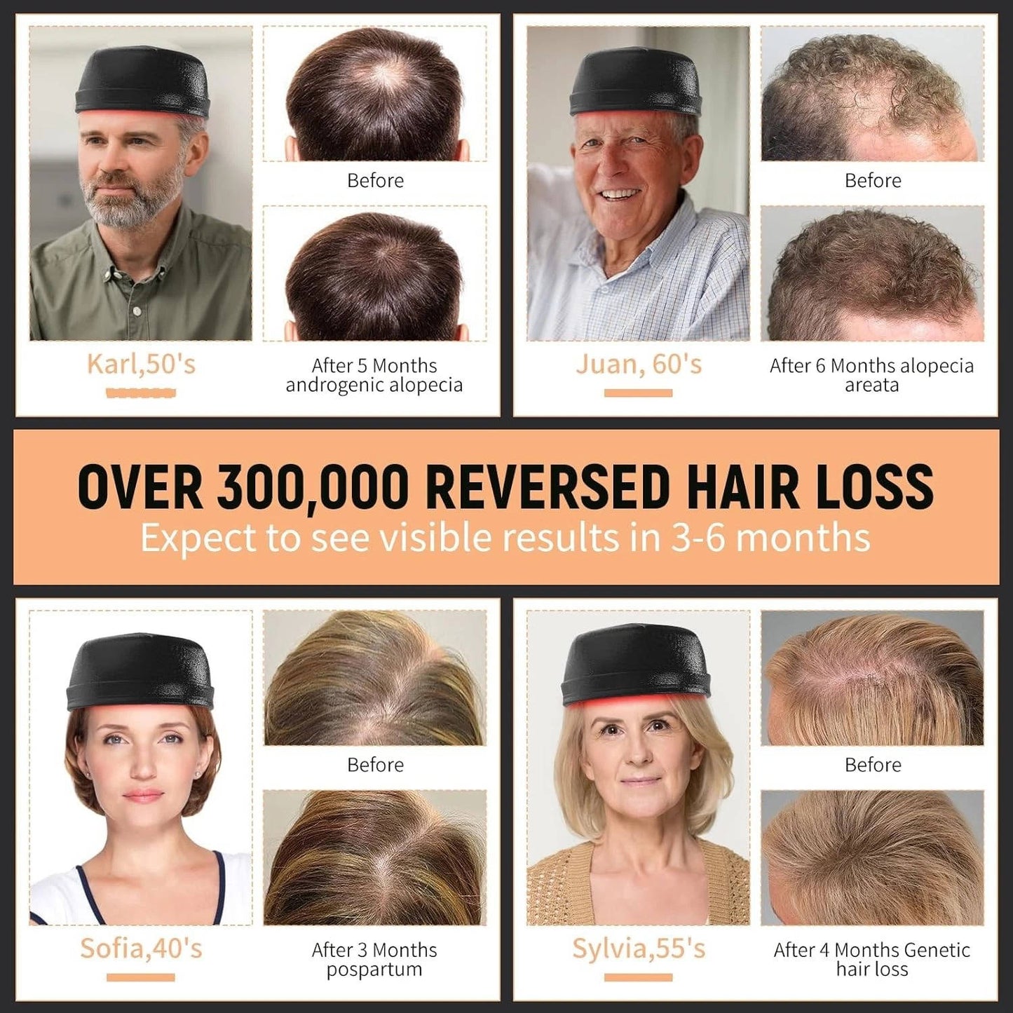 Annie’s Fashion Laser Hair Growth Cap - Red Light Hair Loss Therapy 660Nm & 850Nm - Fda Cleared