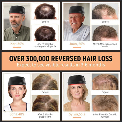 Annie’s Fashion Laser Hair Growth Cap - Red Light Hair Loss Therapy 660Nm & 850Nm - Fda Cleared